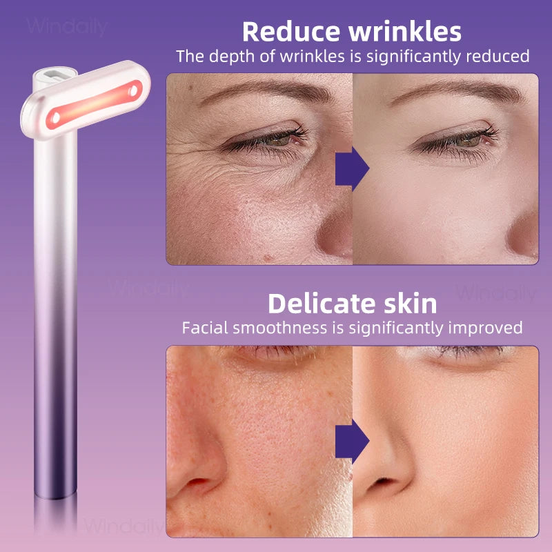 4-in-1 Facial Wand — Red Light, EMS Microcurrent, Vibration & Warmth