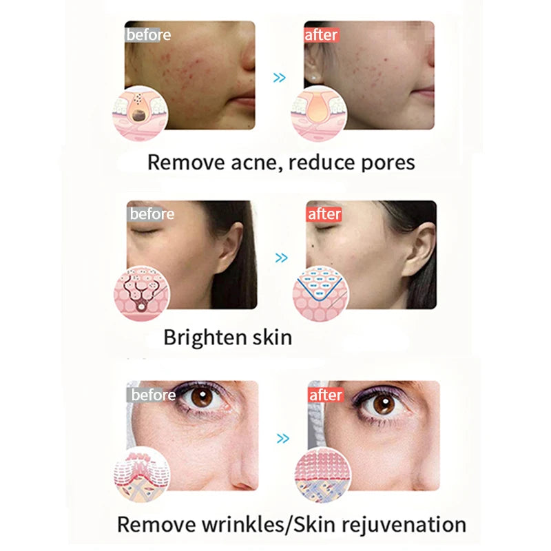 3-Color Photon LED Facial Instrument — Red, Blue & Orange Light