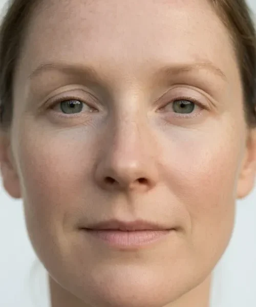 After Skin improvement