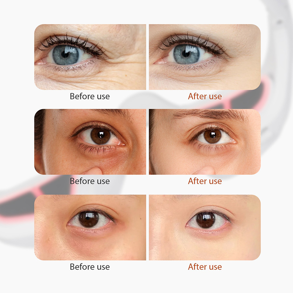 Red Light Eye Massager | Microcurrent EMS for Dark Circles