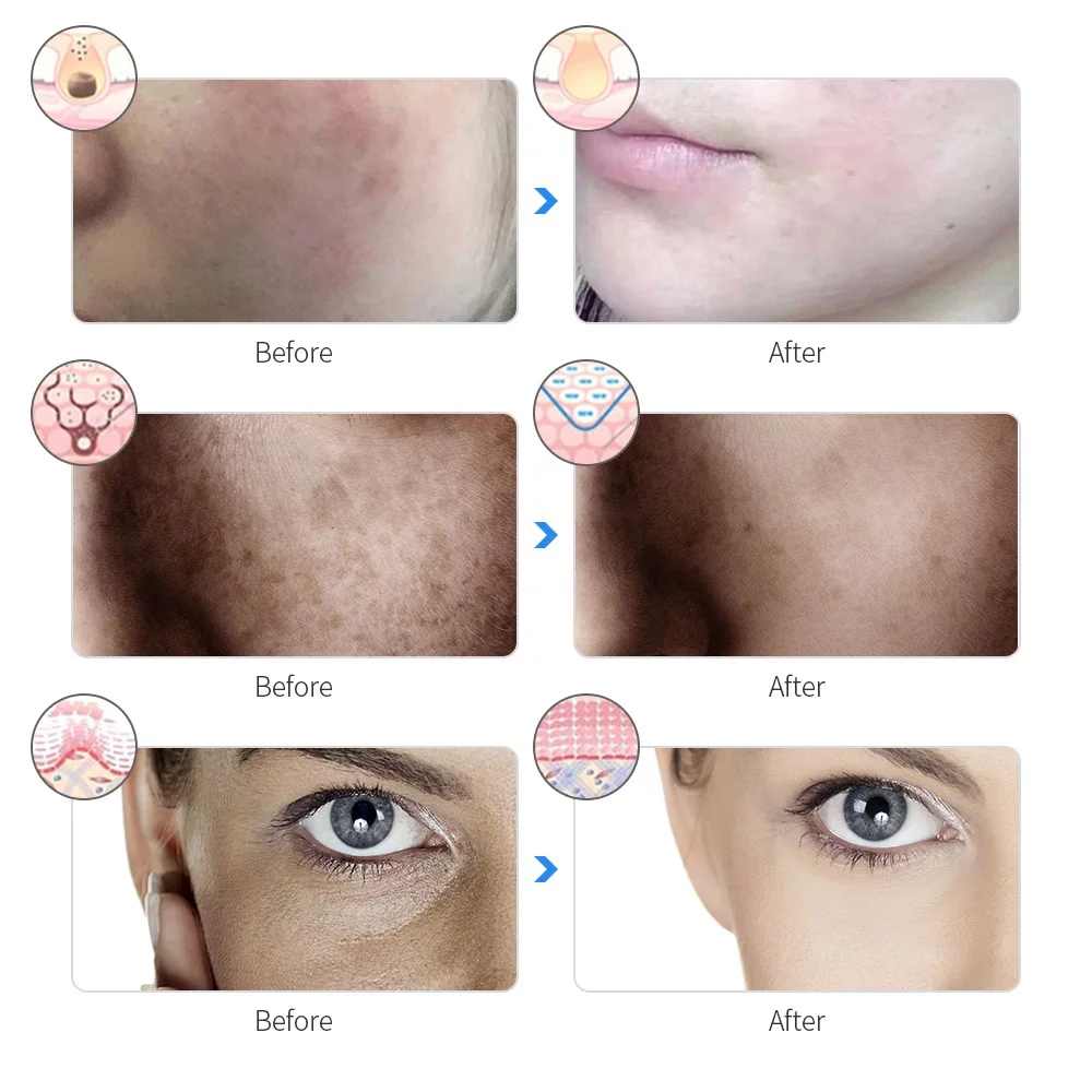 LED Face Mask | 7-Color Cordless Rechargeable Light Therapy Mask
